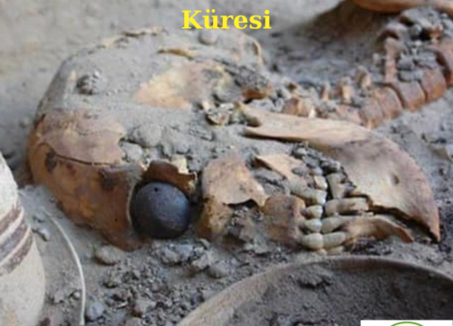 İran – Shahr-i-Sokhta Yapay Göz Küresi