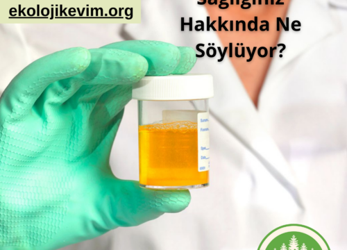 İdrar Renginiz Sağlığınız Hakkında Ne Söylüyor?