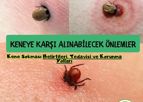 Kene Isırması Nedir? Keneye Karşı Alınabilecek Önlemler